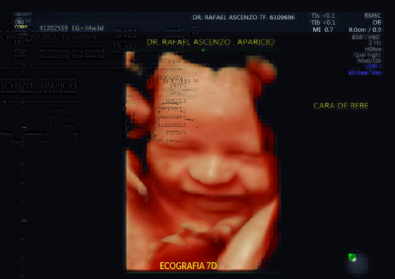 ecografía 7d