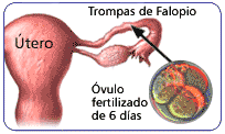 Transferencia de ovocitos microinyectados TOMI