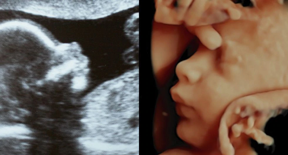 El Comercio, Ecografía 7D